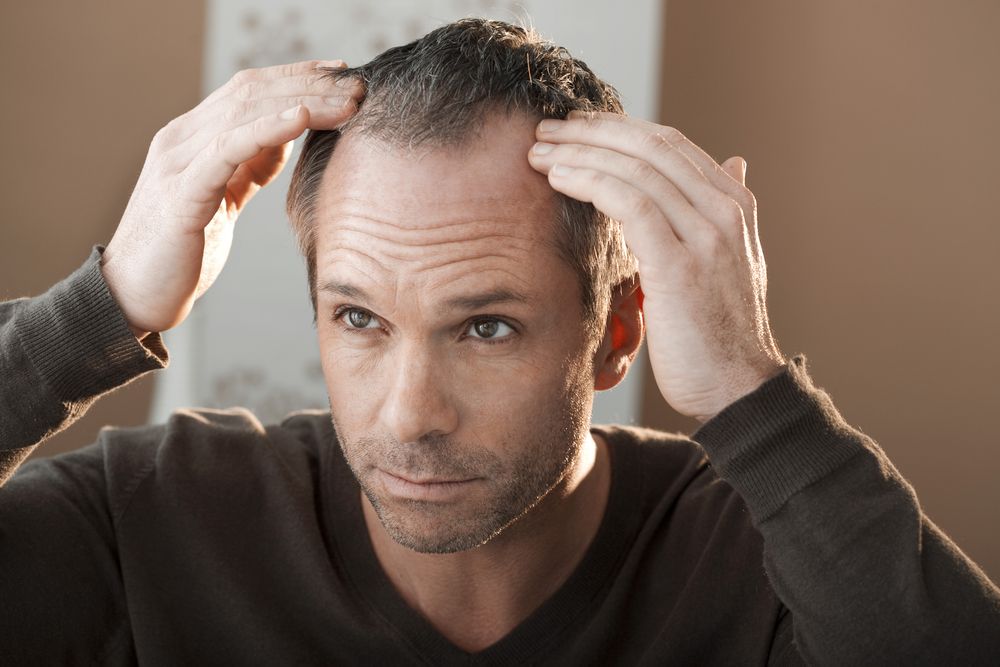 Alopecija | Vrste, simptomi in zdravljenje